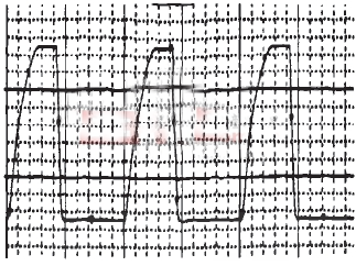 IGBT輸出信號(hào)波形圖